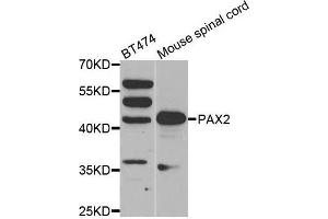 Western blot analysis of extracts of various cell lines, using PAX2 antibody.