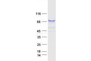 Validation with Western Blot (GUCY1A1 Protein (Transcript Variant 1) (Myc-DYKDDDDK Tag))