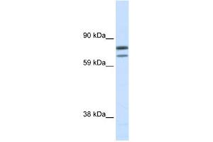 WB Suggested Anti-ZFPM1 Antibody Titration:  0. (ZFPM1 antibody  (N-Term))