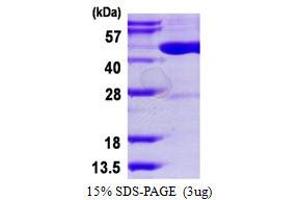 Image no. 1 for tRNA Aspartic Acid Methyltransferase 1 (TRDMT1) protein (His tag) (ABIN7279780)