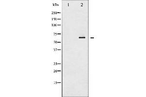 Western blot analysis of SYK expression in UV treated K562 whole cell lysates,The lane on the left is treated with the antigen-specific peptide. (SYK antibody)