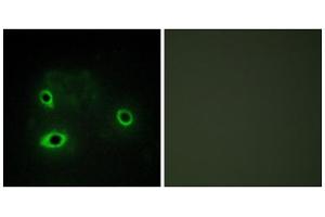 Immunofluorescence analysis of COS7 cells, using COX42 antibody. (COX4I2 antibody  (Internal Region))