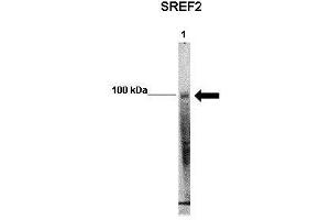 WB Suggested Anti-SREBF2 Antibody    Positive Control:  Lane 1: 50ug mouse glomerular endothelial lysate   Primary Antibody Dilution :   1:1000   Secondary Antibody :  Anti-rabbit-HRP   Secondry Antibody Dilution :   1:5000   Submitted by:  Xiaoxin Wang, UC Denver (SREBF2 antibody  (Middle Region))