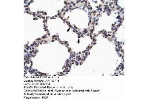 Human Lung (NFKB2 antibody  (N-Term))