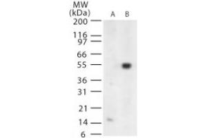 Image no. 1 for anti-West Nile Virus (WNV) (AA 73-86) antibody (ABIN199990) (West Nile Virus antibody  (AA 73-86))
