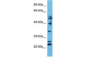 Host:  Rabbit  Target Name:  ZFP41  Sample Type:  Liver Tumor lysates  Antibody Dilution:  1. (ZNF41 antibody  (N-Term))