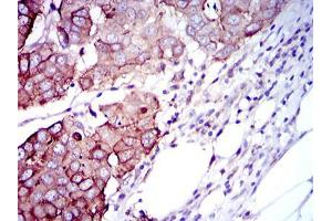 Immunohistochemistry (IHC) image for anti-Ribosomal Protein S6 Kinase, 70kDa, Polypeptide 1 (RPS6KB1) antibody (ABIN969565)