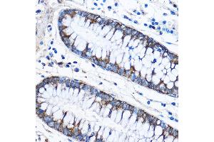 Immunohistochemistry (IHC) image for anti-Capping Protein (Actin Filament) Muscle Z-Line, alpha 2 (CAPZA2) (AA 1-286) antibody (ABIN3022801)