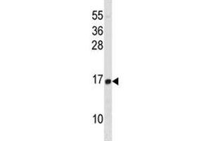 HIST1H2BD antibody western blot analysis in HL-60 lysate. (HIST1H2BD antibody  (AA 1-30))