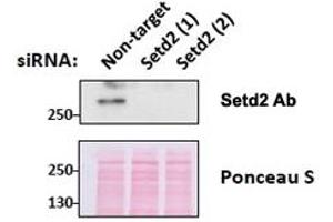 Western blot testing of mouse fibroblast lysates transiently expressing unrelated and two different siRNA with SETD2 antibody at 0. (SETD2 antibody)