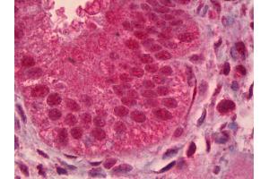 Anti-PAX9 antibody IHC of human uterus, endometrium. (PAX9 antibody)