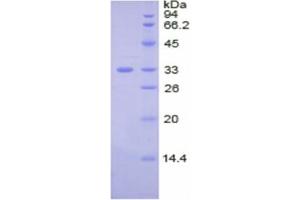 SDS-PAGE of Protein Standard from the Kit (Highly purified E. (Ceruloplasmin CLIA Kit)