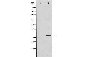 Western blot analysis of TNNI3 expression in Mouse hearttissue lysates,The lane on the left is treated with the antigen-specific peptide. (TNNI3 antibody)