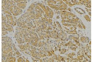 ABIN6279328 at 1/100 staining Human pancreas tissue by IHC-P. (CNTNAP3 antibody  (Internal Region))