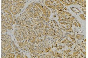 ABIN6279328 at 1/100 staining Human pancreas tissue by IHC-P.