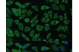Immunofluorescence analysis of L929 cells using ARL3 Polyclonal Antibody at dilution of 1:100 (40x lens). (ARL3 antibody)