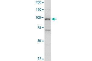 TOP1 monoclonal antibody (M01), clone 1A1. (Topoisomerase I antibody  (AA 692-765))