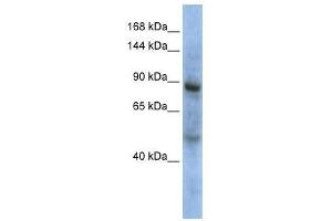 ZHX3 antibody used at 0. (ZHX3 antibody  (Middle Region))