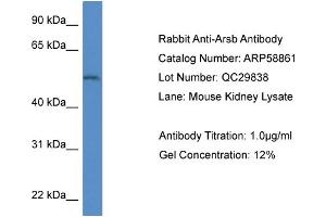 Western Blotting (WB) image for anti-Arylsulfatase B (ARSB) (Middle Region) antibody (ABIN2787854) (Arylsulfatase B antibody  (Middle Region))