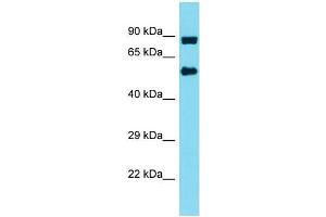 Western Blotting (WB) image for anti-Integrator Complex Subunit 10 (INTS10) (N-Term) antibody (ABIN2791593) (INTS10 antibody  (N-Term))