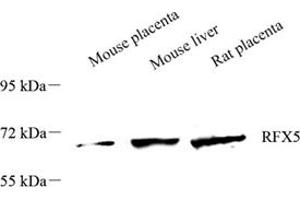 Western blot analysis of RFX5 (ABIN7075399),at dilution of 1: 1500 (RFX5 antibody)