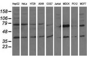 Western blot analysis of extracts (35 µg) from 9 different cell lines by using anti-CBWD1 monoclonal antibody. (CBWD1 antibody)