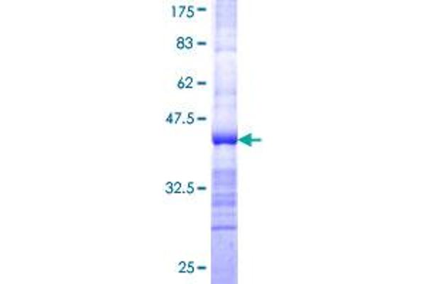 IPMK Protein (AA 251-360) (GST tag)