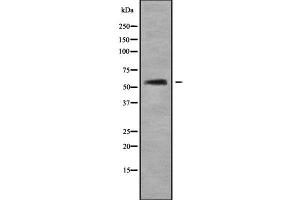 Western blot analysis of AGXT2 using COLO205 whole cell lysates (AGXT2 antibody  (Internal Region))