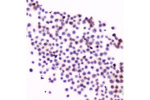 IHC analysis of CD11a using anti-CD11a antibody (ABIN5518766). (ITGAL antibody  (AA 161-349))