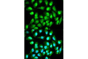 Immunofluorescence analysis of HeLa cells using RAN antibody (ABIN5970364). (RAN antibody)