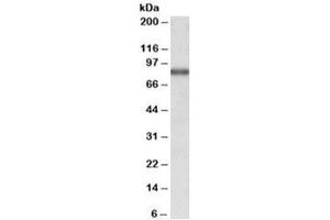 Western blot testing of MCF7 lysate with ALDH18A1 antibody at 1ug/ml. (P5CS antibody)