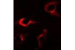 Immunofluorescent analysis of FKBP8 staining in A549 cells. (FKBP8 antibody)