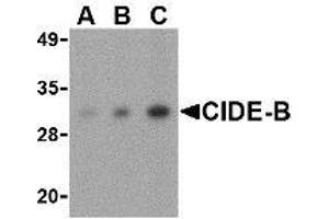 Western blot analysis of CIDE-B in mouse small intestine tissue lysate with AP30233PU-N CIDE-B antibody at (A) 0. (CIDEB antibody  (Center))