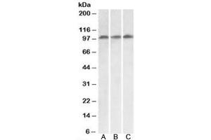 Western blot testing of HeLa [A], HepG2 [B] and Jurkat [C] lysates with VPS16 antibody at 0. (VPS16 antibody  (Isoform 1))