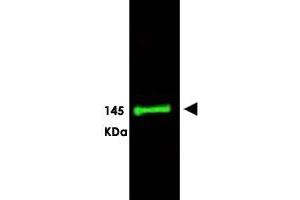 Western blot using SLIT3 polyclonal antibody  shows detection ofa predominant band at ~145 KDa corresponding to SLIT3 (arrowhead) in a bovine thyroid tissue lysate using the 800 nm channel (green). (SLIT3 antibody  (AA 1164-1177))