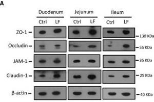 The effects of L. (Claudin 1 antibody  (AA 1-211))