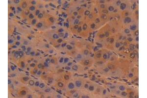 DAB staining on IHC-P; Samples: Human Liver Tissue (Sialoadhesin/CD169 antibody  (AA 34-240))