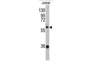 Western blot analysis of ZBTB2 antibody (C-term) in Jurkat cell line lysates (35ug/lane). (ZBTB2 antibody  (C-Term))