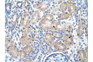 Image no. 1 for anti-Uroporphyrinogen Decarboxylase (UROD) (AA 101-150) antibody (ABIN203398) (UROD antibody  (AA 101-150))