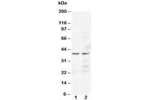 Western blot testing of CCR5 antibody and Lane 1:  Jurkat;  2: COLO320 cell lysate