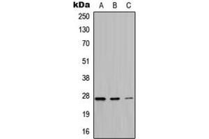 Western blot analysis of ATP6 expression in HeLa (A), A549 (B), PC12 (C) whole cell lysates.
