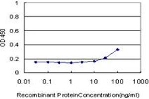 Detection limit for recombinant GST tagged GTF3A is approximately 30ng/ml as a capture antibody. (GTF3A antibody  (AA 185-274))