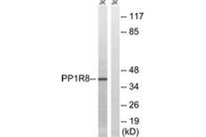 Western blot analysis of extracts from Jurkat cells, using PPP1R8 Antibody. (PPP1R8 antibody  (AA 196-245))