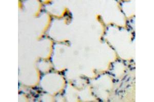 IHC-P analysis of Lung tissue, with DAB staining. (TLR7 antibody  (AA 890-1037))