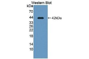 Detection of Recombinant SLC39A6, Human using Polyclonal Antibody to Solute Carrier Family 39, Member 6 (SLC39A6) (SLC39A6 antibody  (AA 29-325))