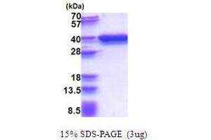 SDS-PAGE (SDS) image for Regulation of Nuclear Pre-mRNA Domain Containing 1A (RPRD1A) (AA 1-312) protein (His tag) (ABIN5853662)