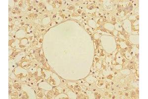 Immunohistochemistry of paraffin-embedded human adrenal gland tissue using ABIN7172318 at dilution of 1:100 (TRIAP1 antibody  (AA 1-76))