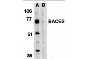 Western Blotting (WB) image for anti-beta-Site APP-Cleaving Enzyme 2 (BACE2) (C-Term) antibody (ABIN1030277) (BACE2 antibody  (C-Term))