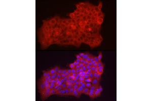 Immunofluorescence analysis of  cells using Fbx32/FBOX32 Rabbit pAb (ABIN3017561, ABIN3017562, ABIN3017563, ABIN1679825 and ABIN6220155) at dilution of 1:50 (40x lens).