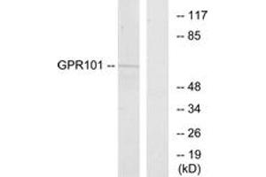Western blot analysis of extracts from COS7 cells, using GPR101 Antibody. (GPR101 antibody  (AA 451-500))